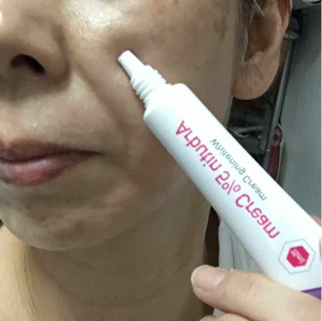 アルブチン5%クリーム/エルツティン/フェイスクリームを使ったクチコミ（1枚目）