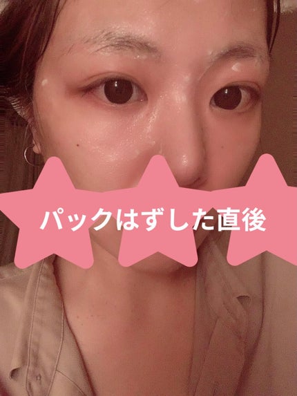 ブライトニング バブルトックス セラムマスク/MEDIHEAL/シートマスク・パックを使ったクチコミ(3枚目)