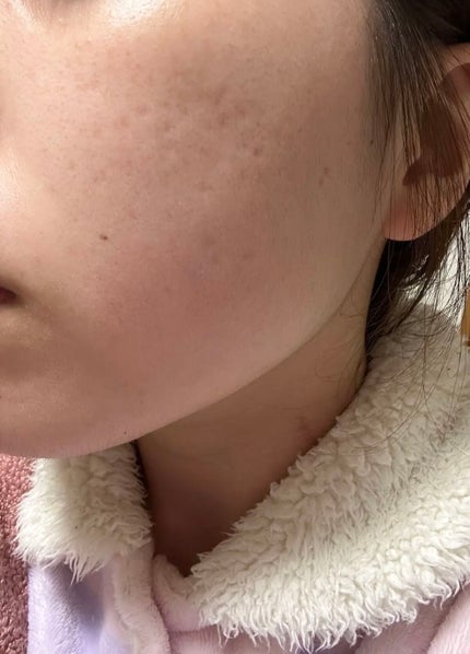 ガラクナイアシン2.0エッセンス/manyo/美容液を使ったクチコミ(3枚目)