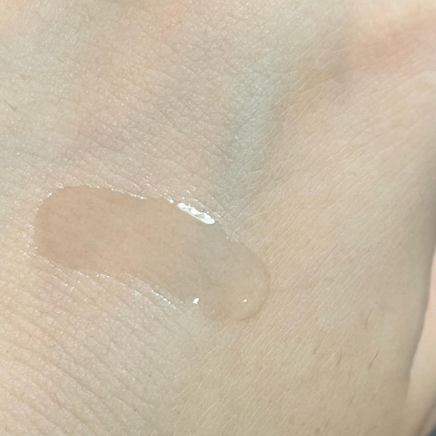 バイオイル/バイオイル/フェイスオイルを使ったクチコミ(3枚目)