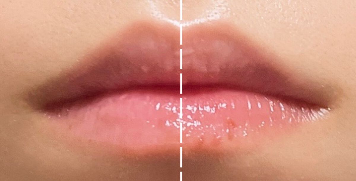 エッセンス リッププランパー/Visée/リッププランパーを使ったクチコミ(2枚目)