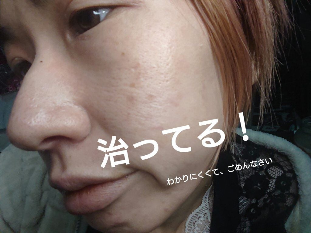 N.M.FアクアアンプルマスクJEX/MEDIHEAL/シートマスク・パックを使ったクチコミ(3枚目)