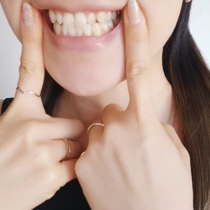 あたりちゃん♥️フォロバ&イイネ返し on LIPS 「【ブレッシュホワイトニングジェル】ホワイトニングを科学した歯が..」(9枚目)