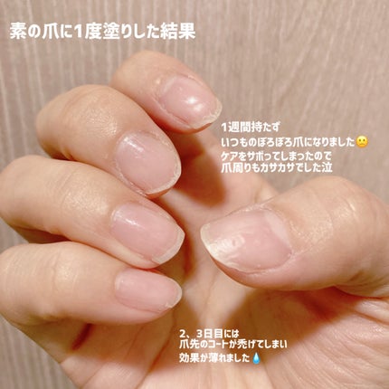 ネイルサポート Na/ネイルネイル/ネイルトップコートを使ったクチコミ(3枚目)
