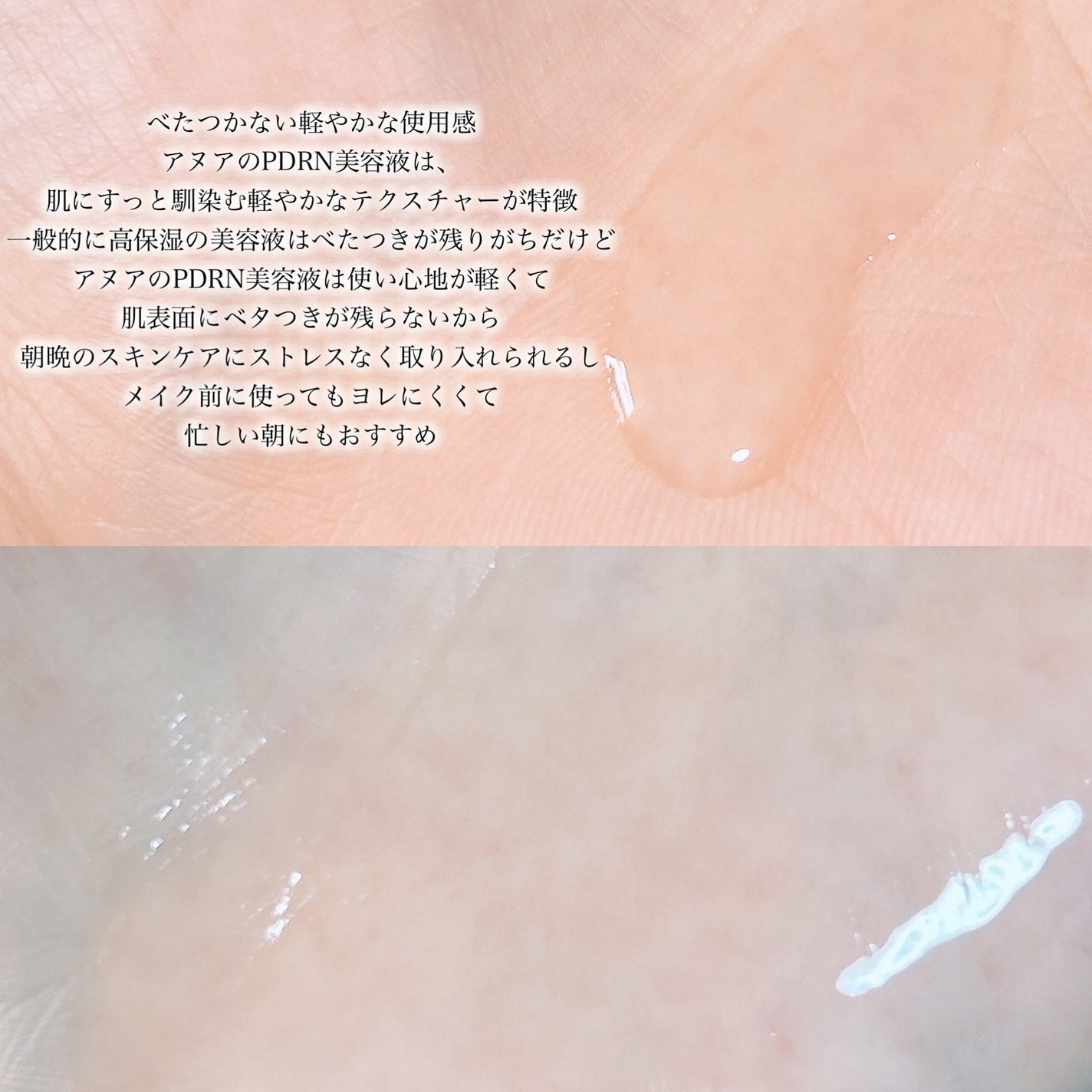 PDRNヒアルロン酸カプセル100セラム/Anua/美容液を使ったクチコミ(3枚目)