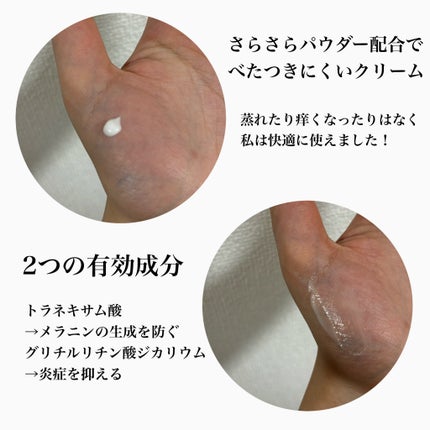 クリニラボ VIOLAO クリア/大正製薬/デリケートゾーンケアを使ったクチコミ(2枚目)