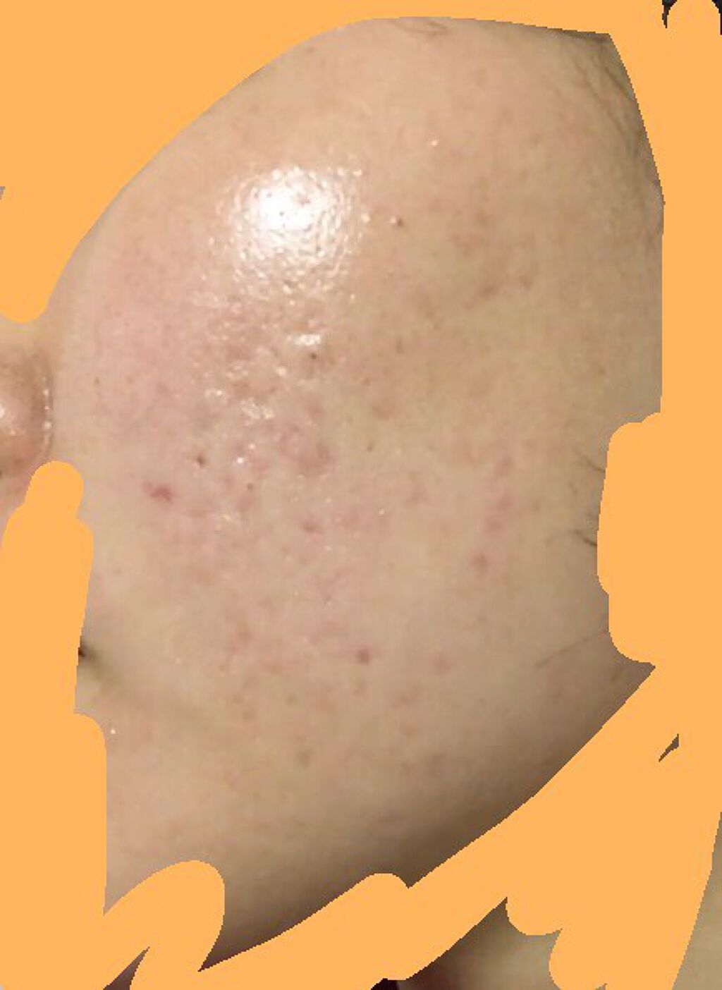 ハトムギ化粧水(ナチュリエ スキンコンディショナー R )/ナチュリエ/化粧水を使ったクチコミ(3枚目)