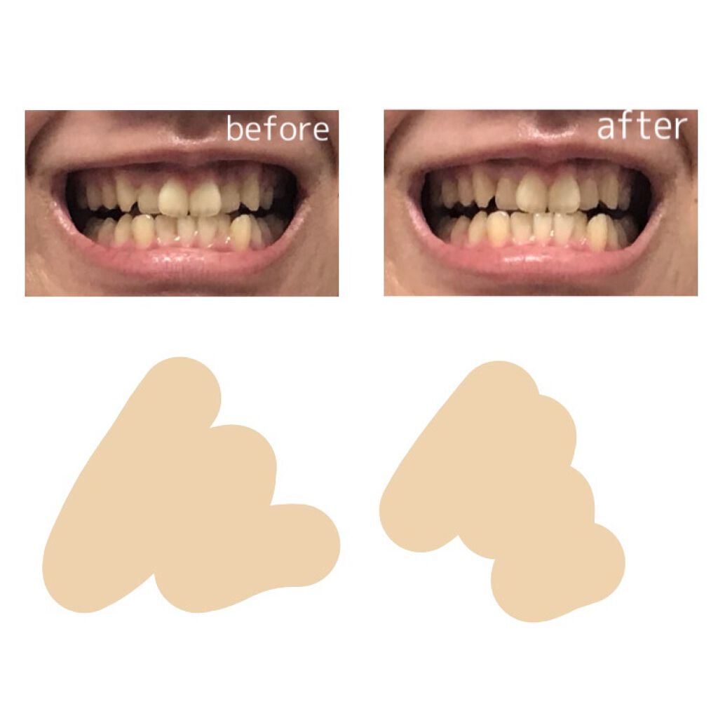 オーラツー プレミアム クレンジングペースト プレミアムミント/オーラツー/歯磨き粉を使ったクチコミ(5枚目)