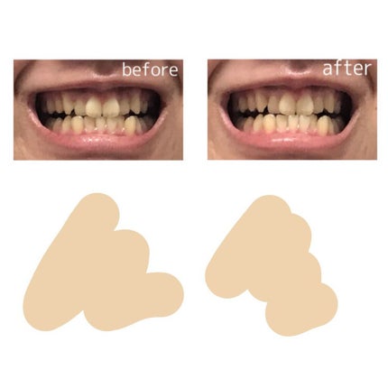 オーラツー プレミアム クレンジングペースト プレミアムミント/オーラツー/歯磨き粉を使ったクチコミ(5枚目)