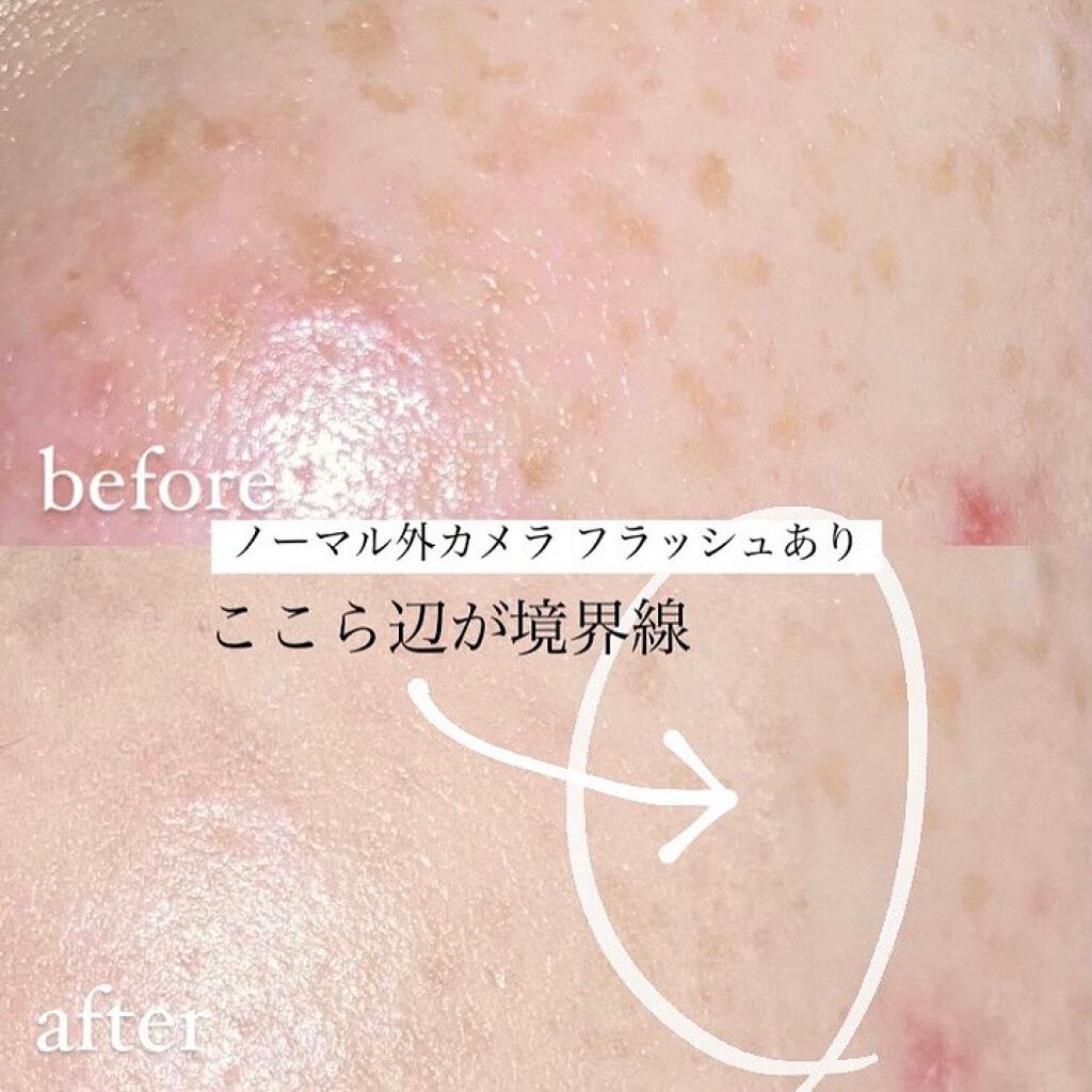 ninal コンシーラーセラム/ninal/リキッドコンシーラーを使ったクチコミ（3枚目）