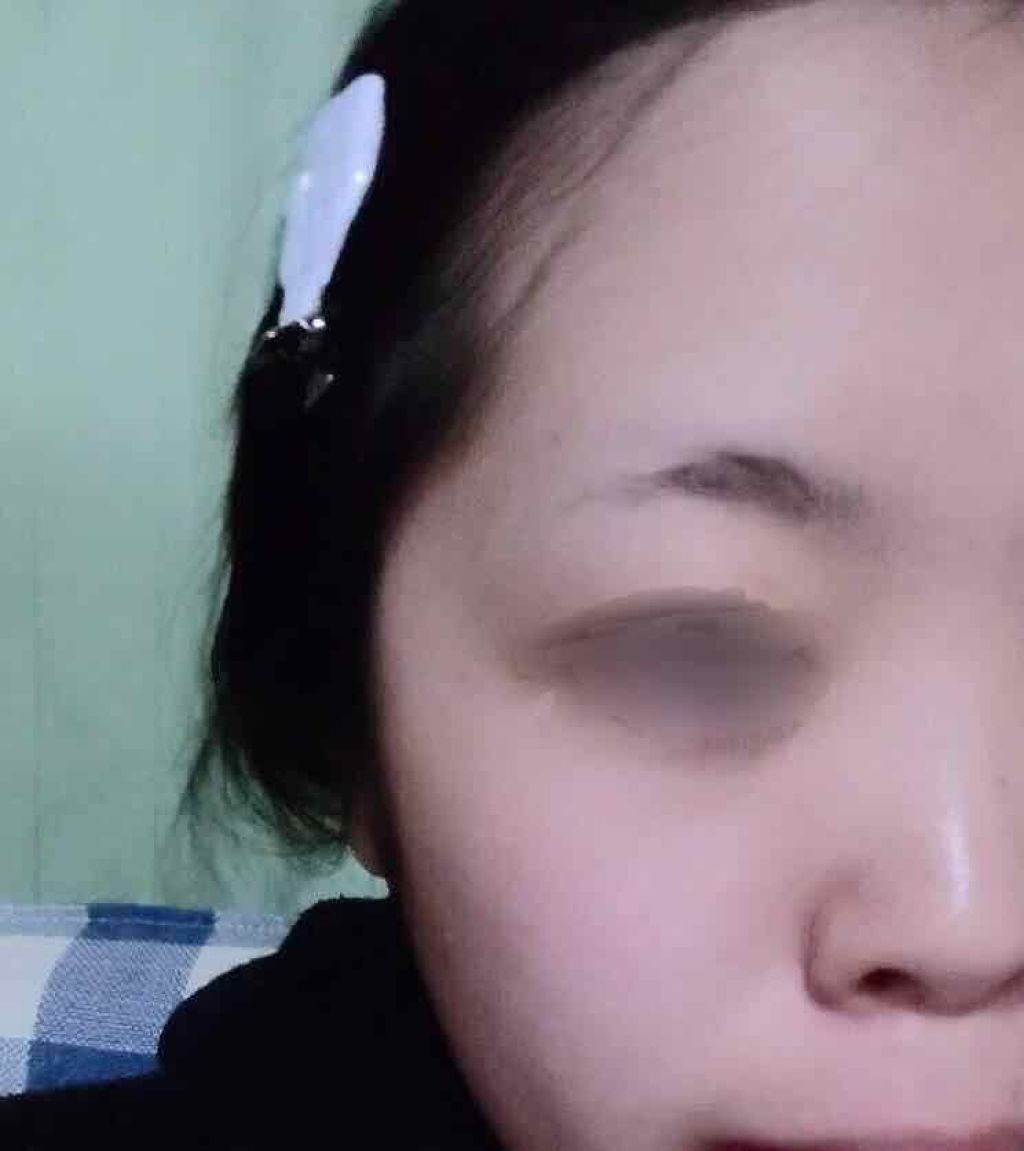 DETクリア ブライト&ピール ピーリングジェリー <ミックスベリーの香り>/Detclear/ピーリングを使ったクチコミ(3枚目)