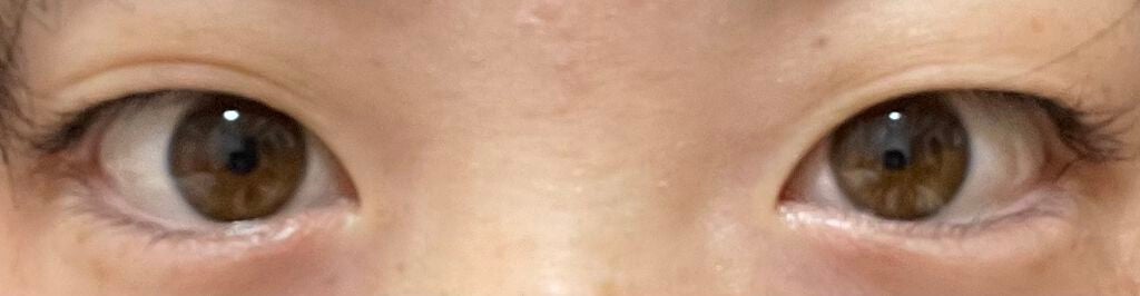 美容初心者 on LIPS 「目がコンプレックスです😢瞼に変な線が入ってしまってたるんでいる..」(1枚目)