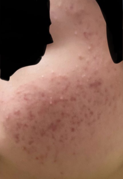 DHC ビタミンCハードカプセル/DHC/美容サプリメントを使ったクチコミ(1枚目)