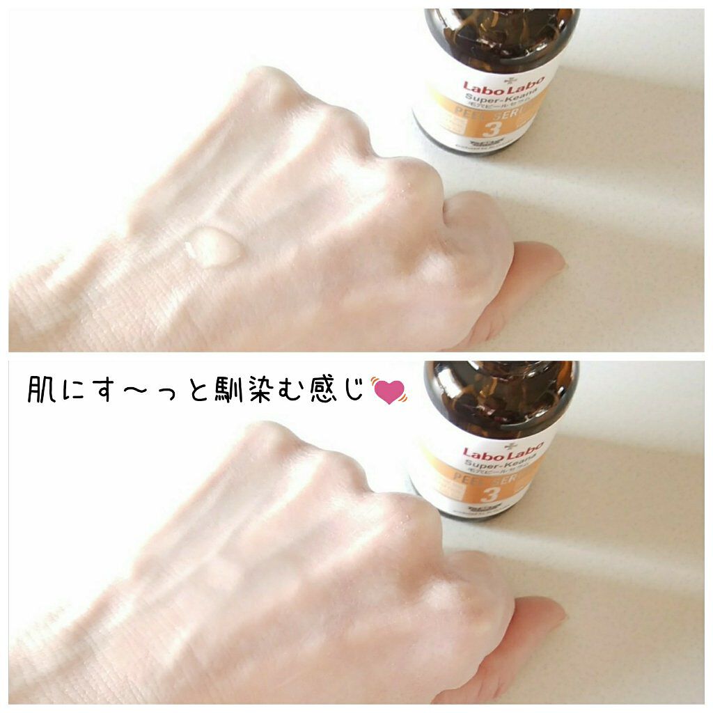 スーパー毛穴ピールセラム/ラボラボ/美容液を使ったクチコミ（3枚目）