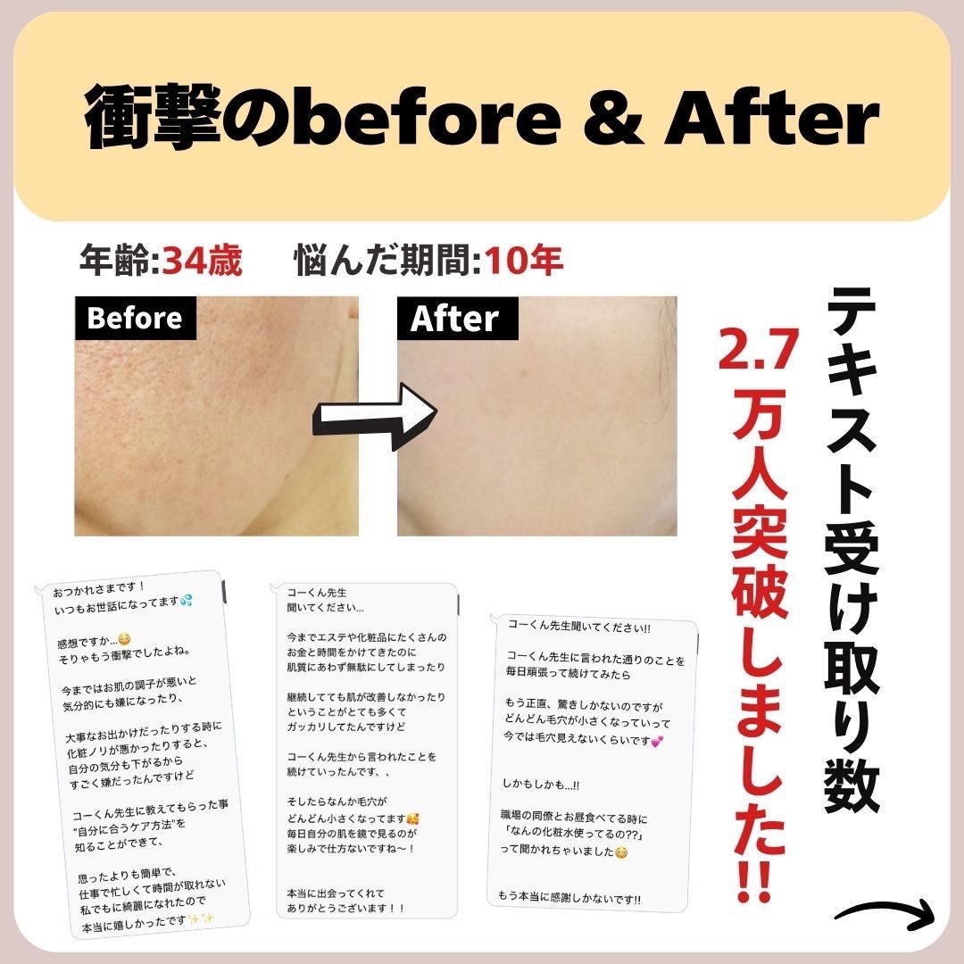 あなたの肌に合ったスキンケア💐コーくん先生 on LIPS 「【あなたは大丈夫!?】顔パック実は危険って本当...!?😱....」(8枚目)