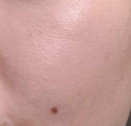 パーフェクトUVリキッドファンデーション/オルビス/リキッドファンデーションを使ったクチコミ(3枚目)