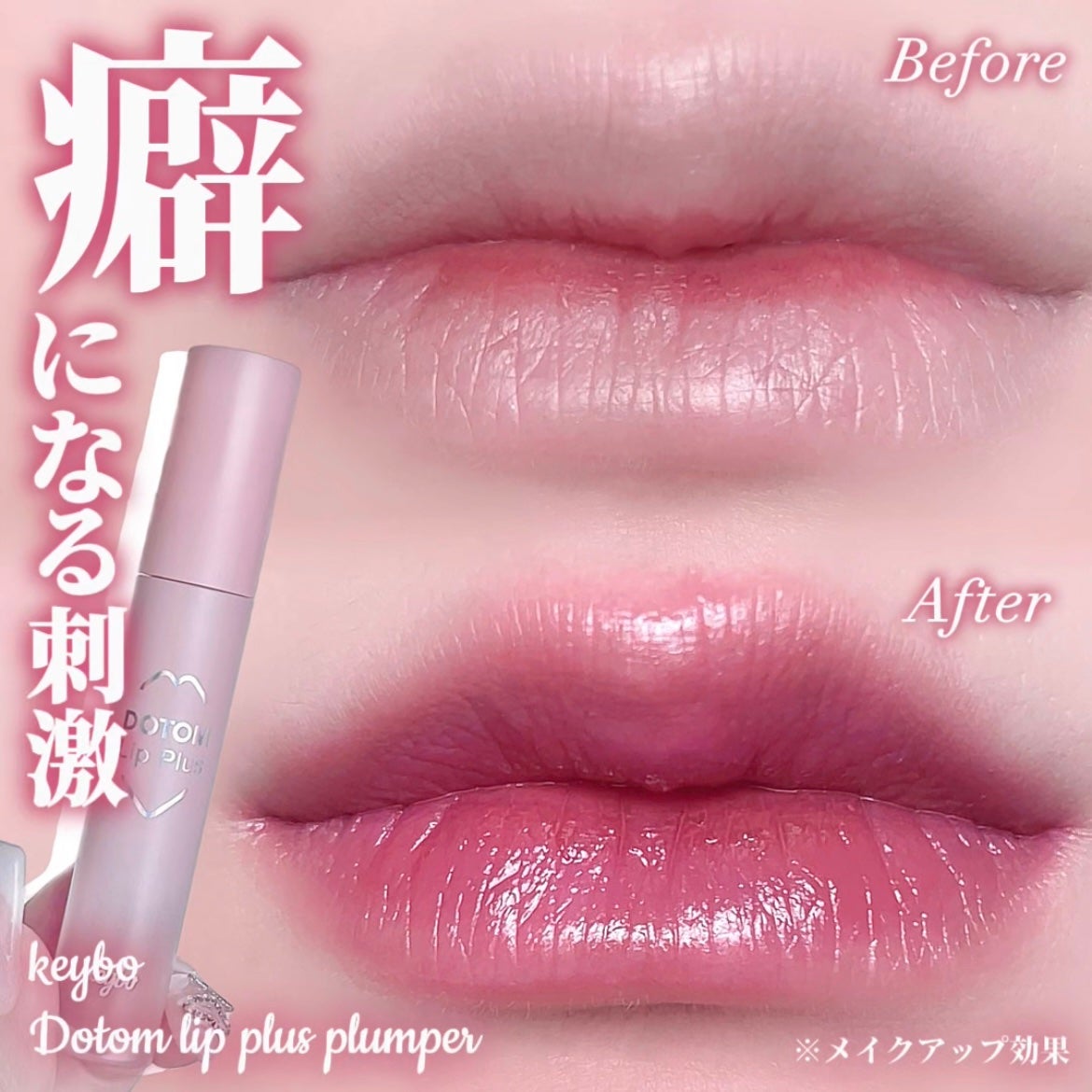 ドトムリッププラスプランパー/keybo/リッププランパーを使ったクチコミ(1枚目)