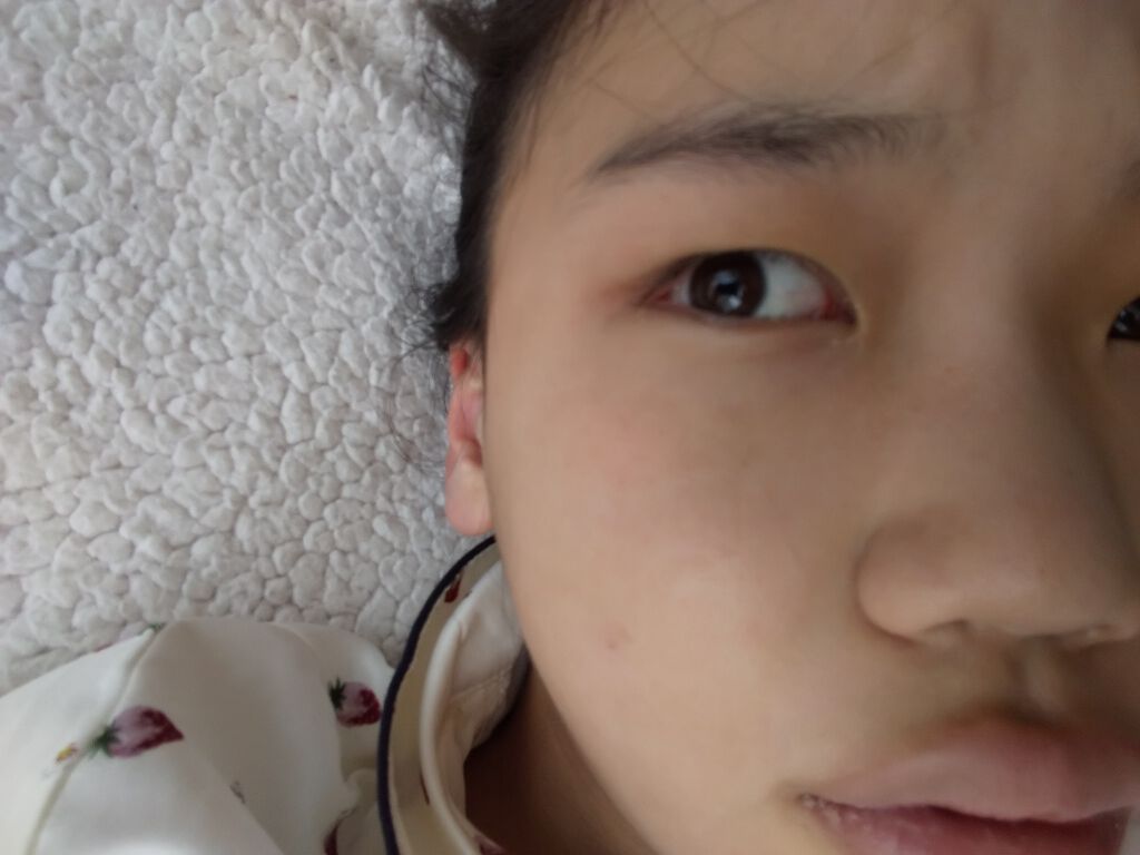 肌色タイプ/バンドエイド/その他を使ったクチコミ（2枚目）