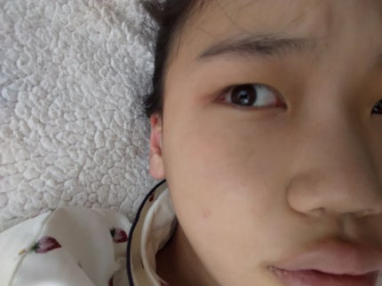 【旧品】オリシキ アイリッドスキンフィルム/D-UP/二重まぶた用アイテムを使ったクチコミ(2枚目)