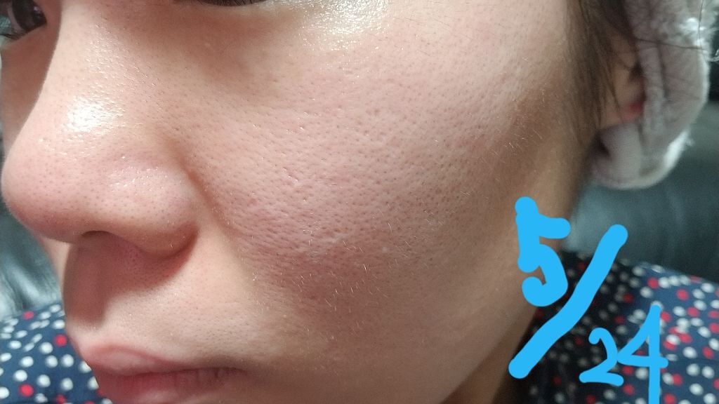 無印良品 クリアケアクリームのクチコミ「24日からこちら使い始めました！
敏感肌用にするか
めっちゃ迷ったんですが…
クリアケアシリー.....」（2枚目）