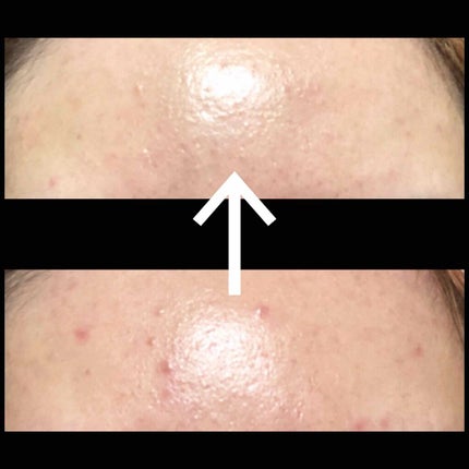 バランスケア エマルジョン R II/d プログラム/乳液を使ったクチコミ(1枚目)