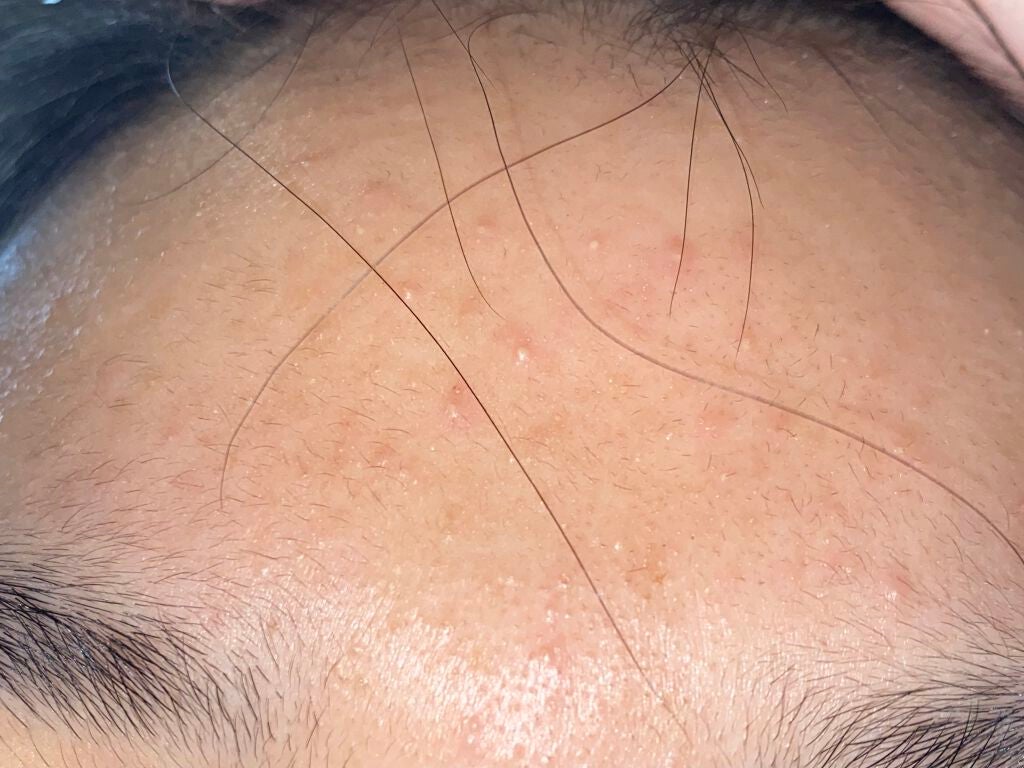 ビビ on LIPS 「顔面記録9日目昨日の更新出来ずサボった感が出てしまって申し訳な..」(3枚目)