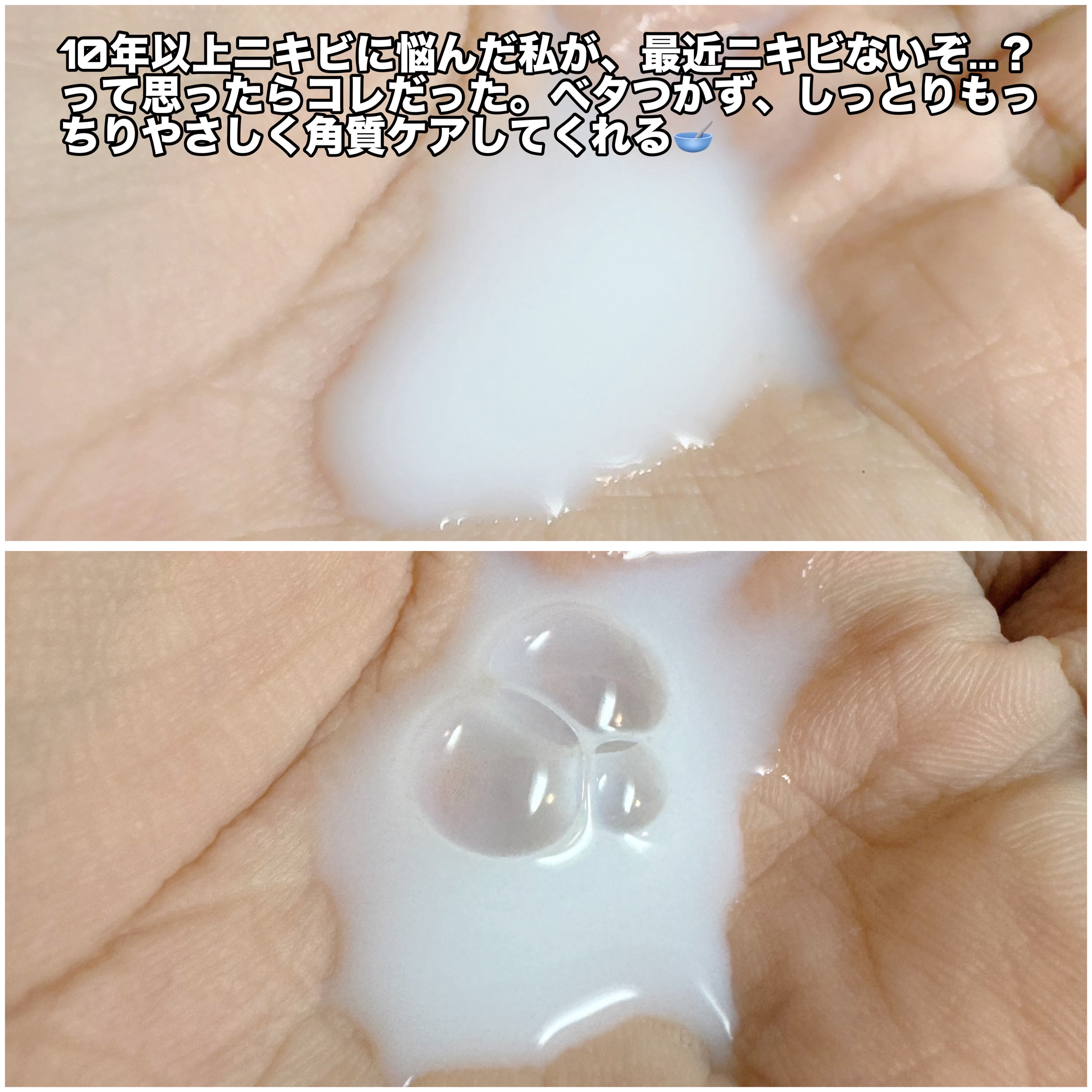 ミルクブライトニングトナー/MEDIHEAL/化粧水を使ったクチコミ（3枚目）