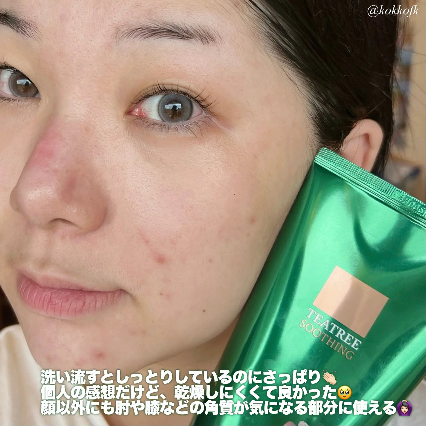ティーツリーハーブピーリングパック/WellDerma/洗い流すパック・マスクを使ったクチコミ(5枚目)