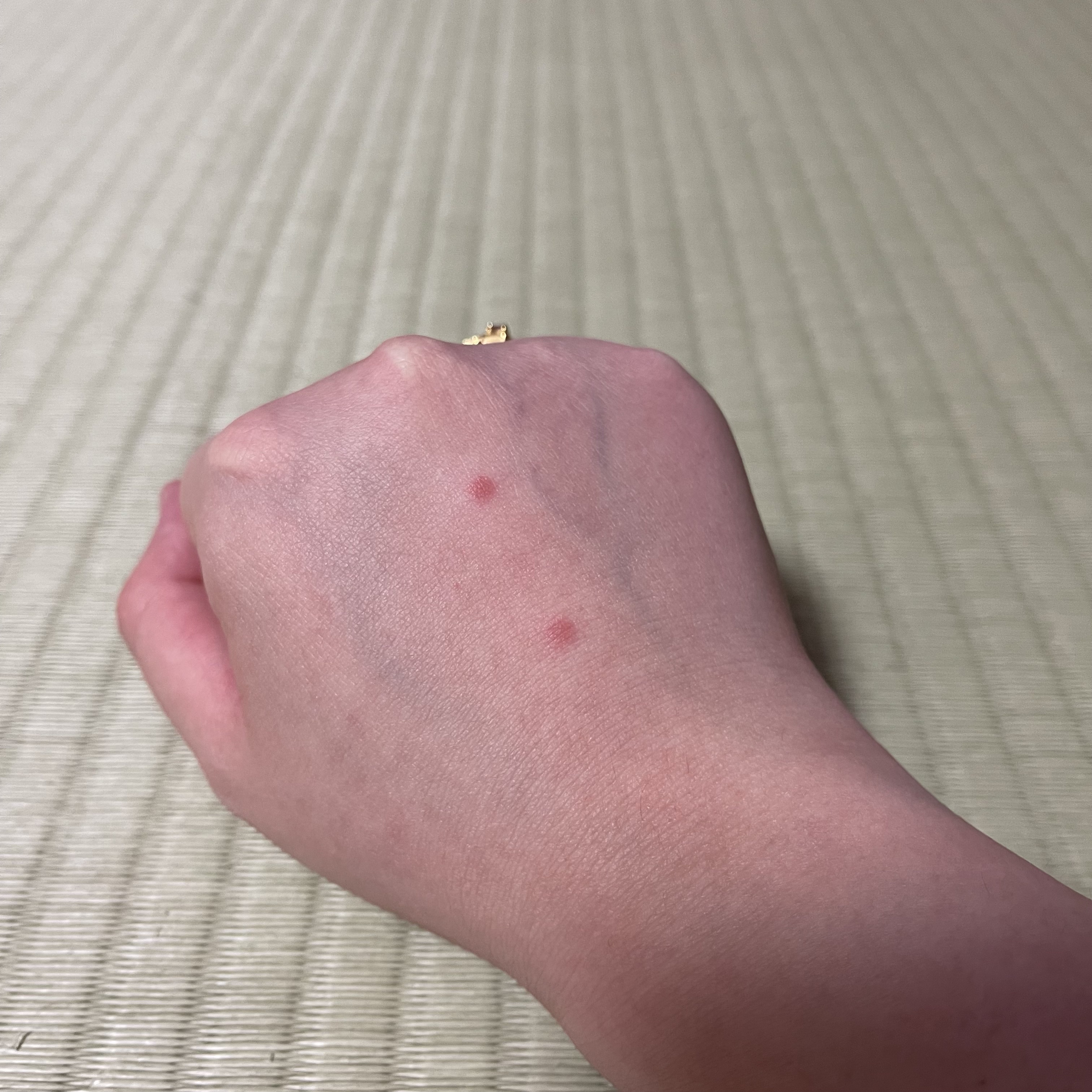 アディクション スキンリフレクト フィックス コンシーラー 001 Porcelain Pink/ADDICTION/リキッドコンシーラーを使ったクチコミ（1枚目）