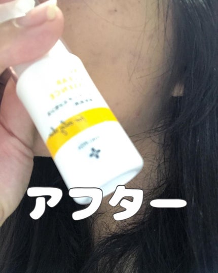 AC CICA クリアローション/NIKI PITA/化粧水を使ったクチコミ(4枚目)