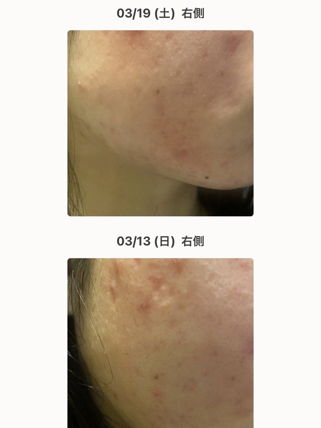 を使ったクチコミ（3枚目）