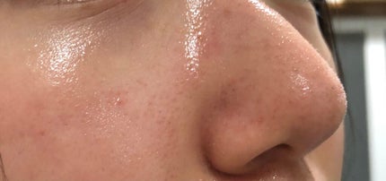 ハトムギ保湿ジェル(ナチュリエ スキンコンディショニングジェル)/ナチュリエ/美容液を使ったクチコミ(5枚目)