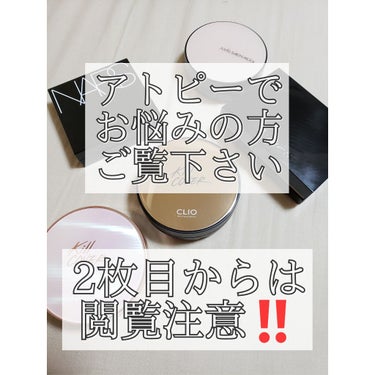 こんにちは👋😃
さゆです。
見てくださってありがとうございます。
今回はわたしの汚肌をさらします。
2枚目からは閲覧注意‼️です。
わたしはアトピー性皮膚炎とともに育ってきました。
小さい頃は手や足が中