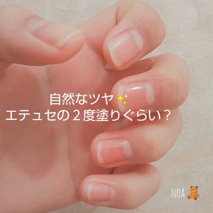 エテュセ クイックケアコート/ettusais/ネイルオイル・トリートメントを使ったクチコミ(2枚目)