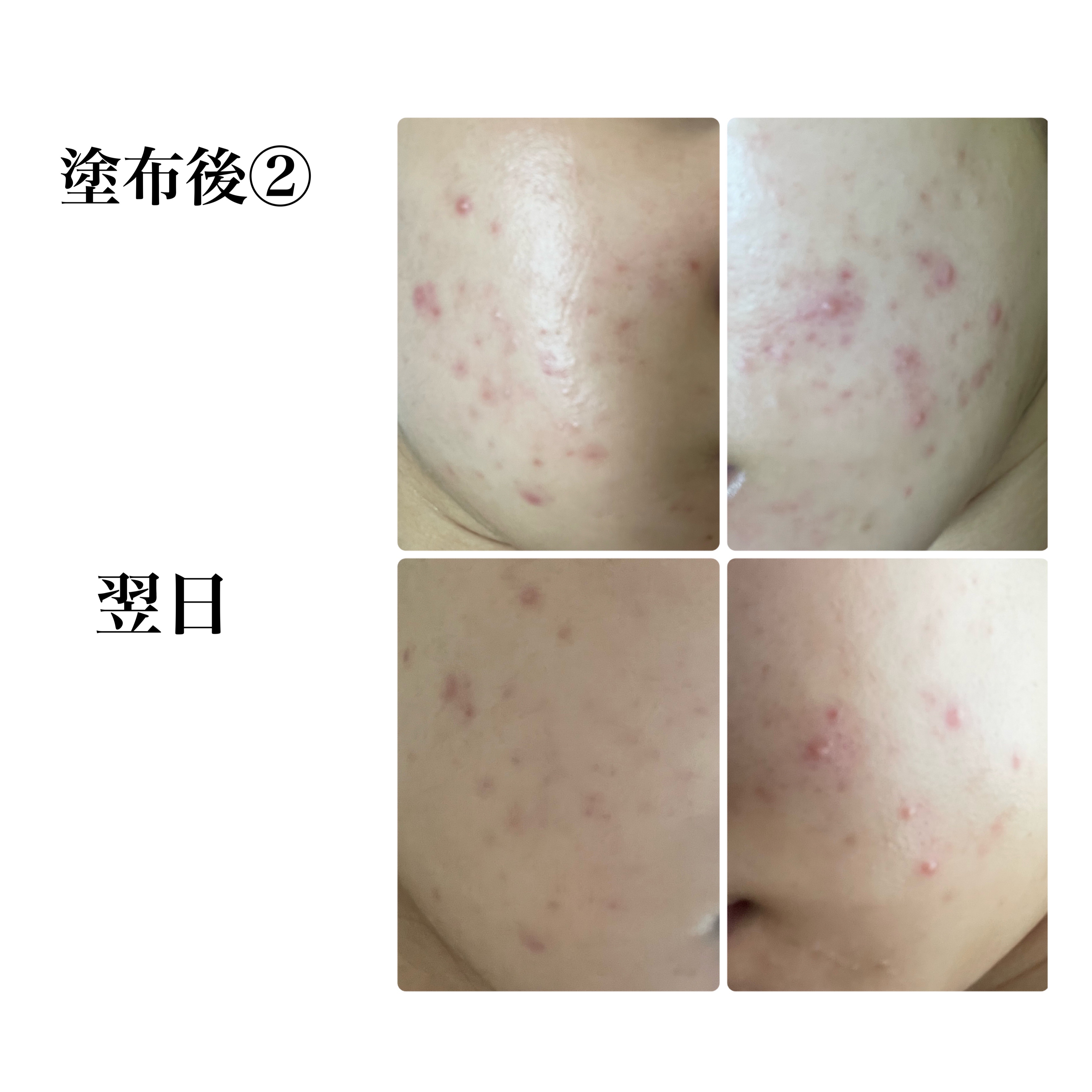 CICA スリーピングマスク/VT/シートマスク・パックを使ったクチコミ（2枚目）