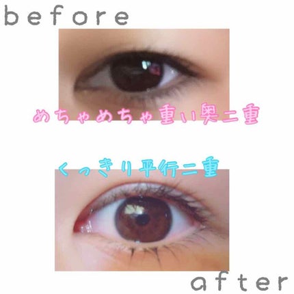 ニベアクリーム/ニベア/ボディクリームを使ったクチコミ(1枚目)