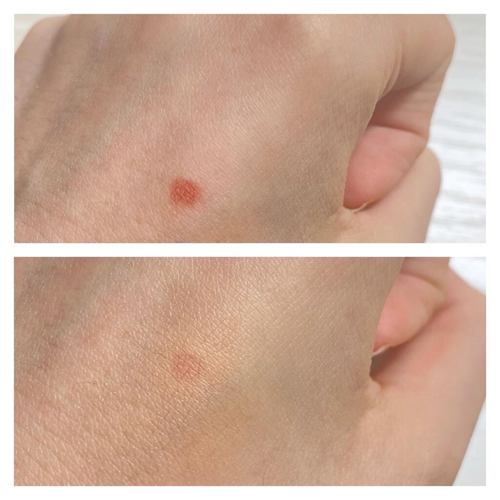 ラディアントクリーミーコンシーラー/NARS/リキッドコンシーラーを使ったクチコミ(5枚目)