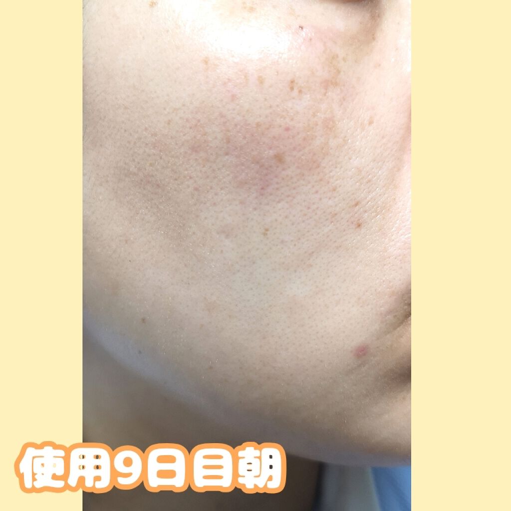 ホワイトニングクリアエマルジョン/d プログラム/乳液を使ったクチコミ（2枚目）