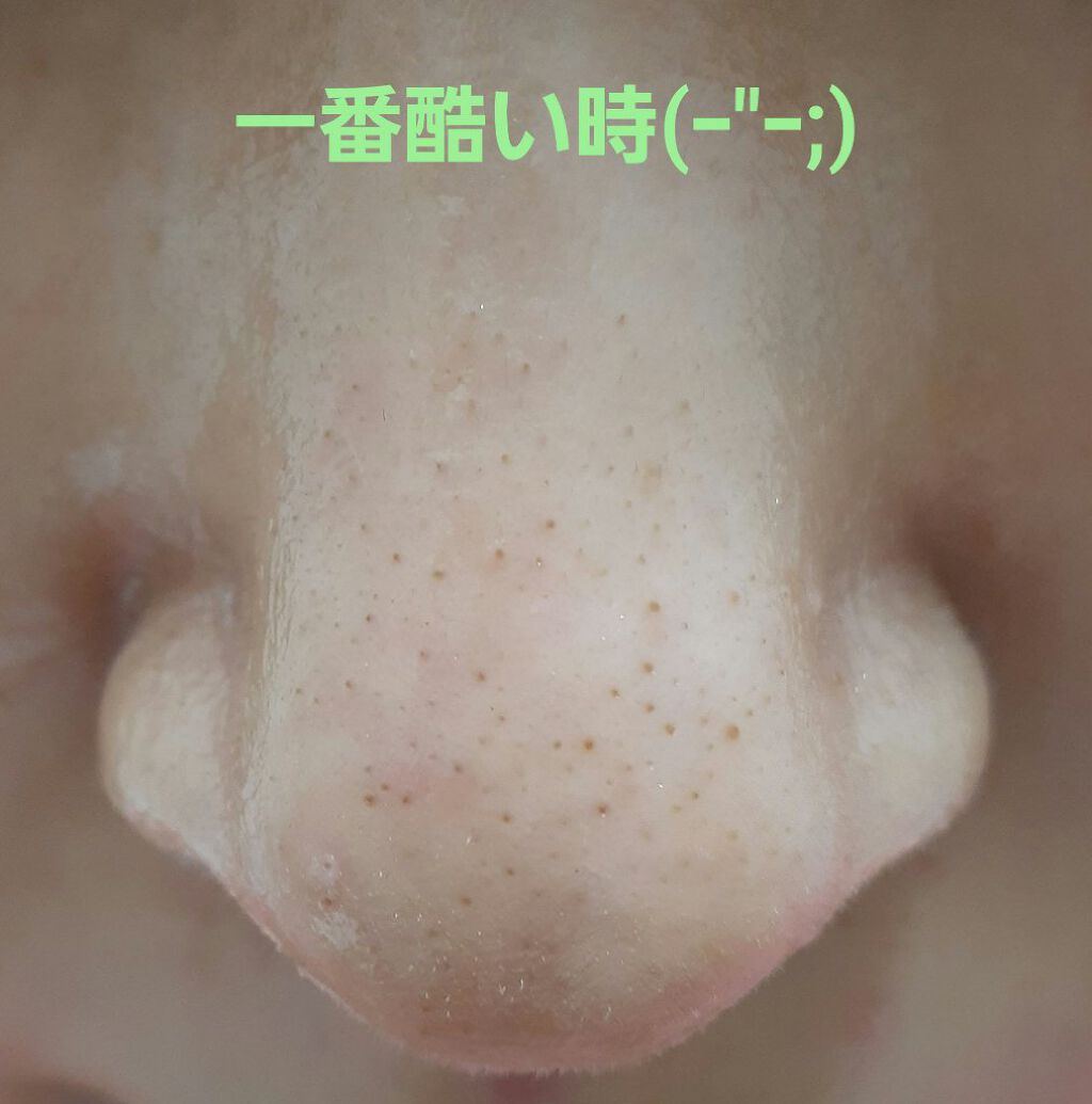 ソフティモ ディープ クレンジングオイル/ソフティモ/オイルクレンジングを使ったクチコミ(2枚目)