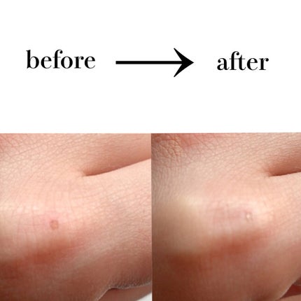 アンリミテッド コンシーラー/shu uemura/リキッドコンシーラーを使ったクチコミ(2枚目)