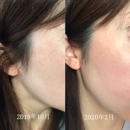 ブライトニングフォーミュラ/メコゾーム/フェイスクリームを使ったクチコミ(4枚目)