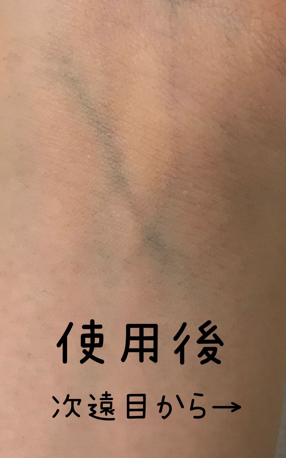 ブライトアップパクト/media/パウダーファンデーションを使ったクチコミ(4枚目)