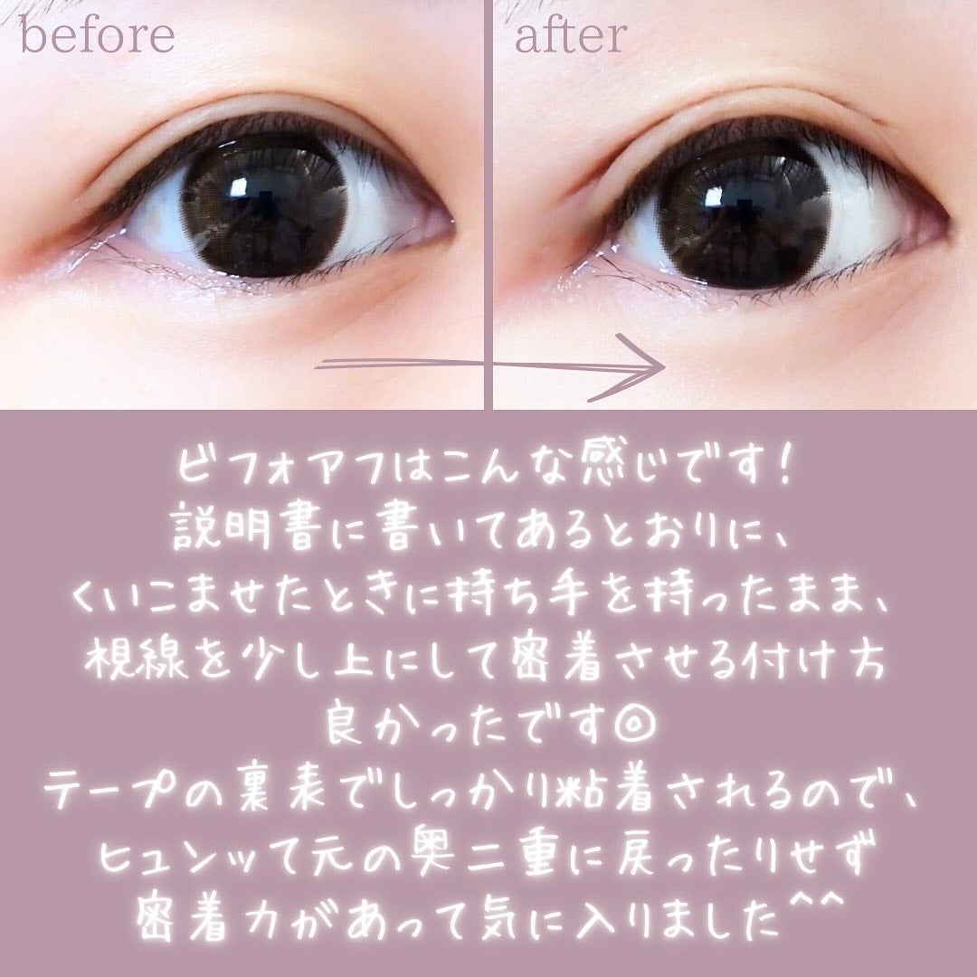 マイクロファイバー /ビー・エヌ/二重まぶた用アイテムを使ったクチコミ(5枚目)