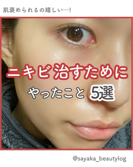 ゼロスポットパッチ/Today’s Cosme/にきびパッチを使ったクチコミ(1枚目)