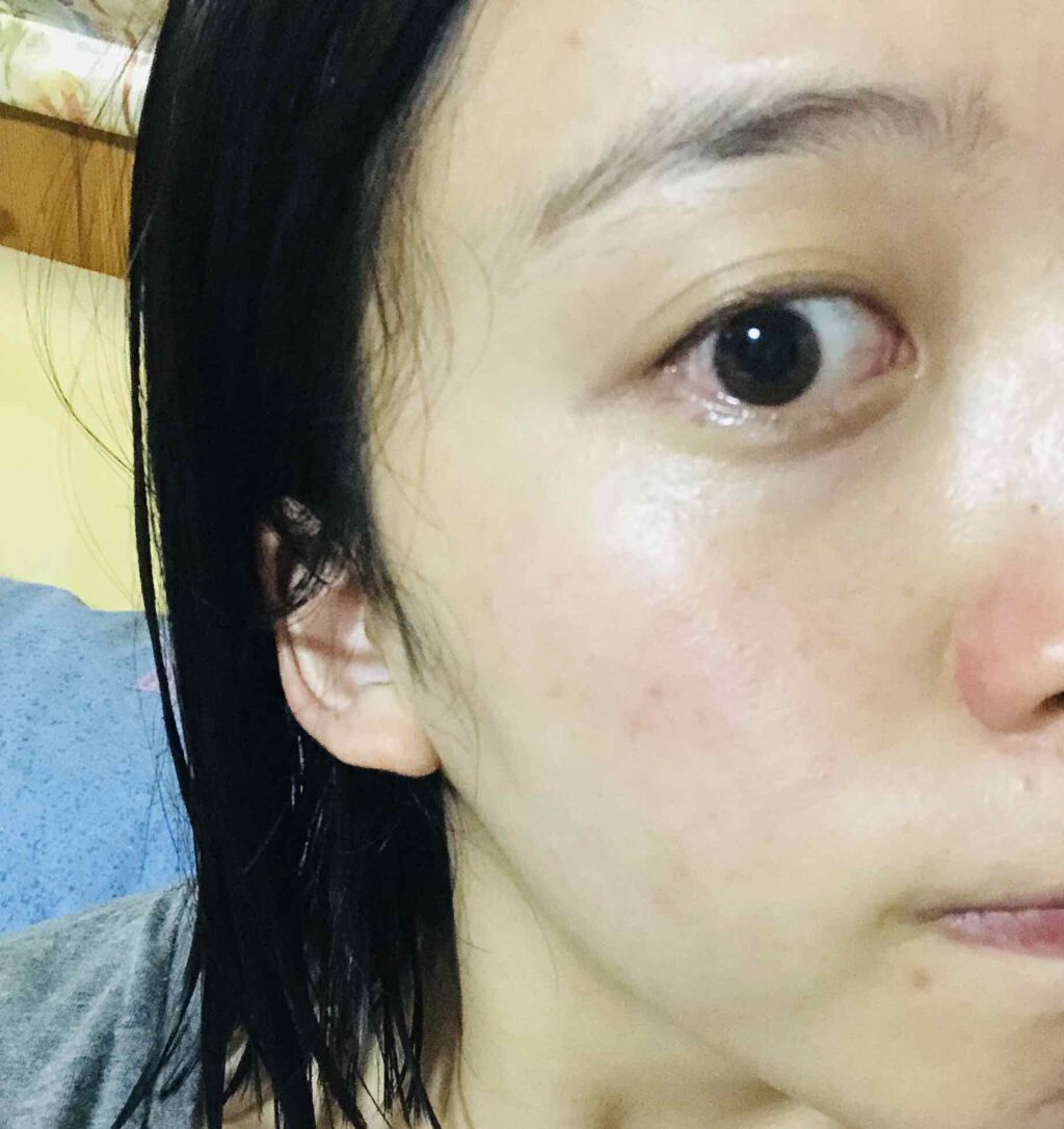 バイオイル/バイオイル/フェイスオイルを使ったクチコミ(3枚目)