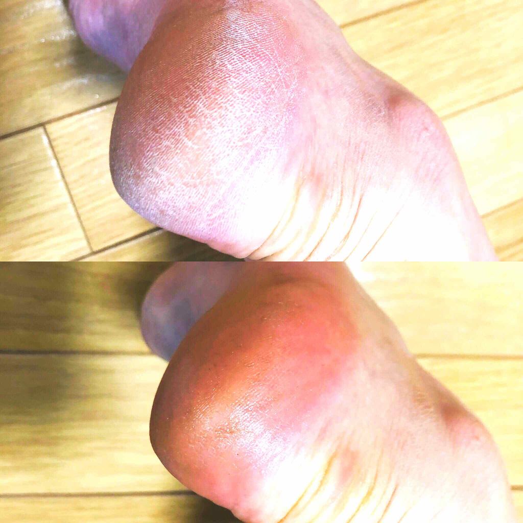 ALOVERA 高保湿スキンケアクリーム/ALOVERA/ボディクリームを使ったクチコミ（1枚目）