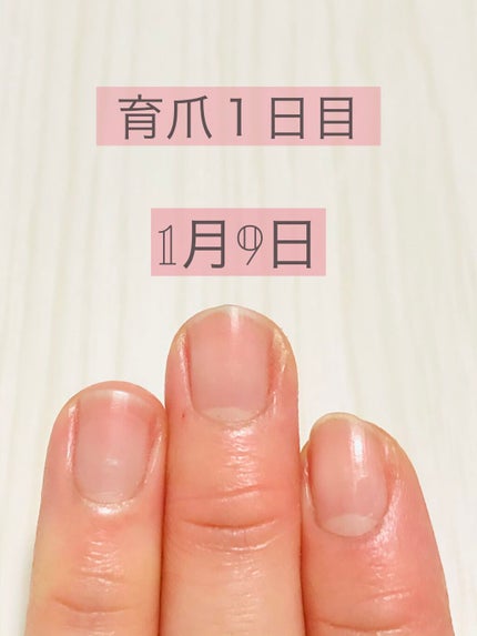 キューティクルオイル/ネイルホリック/ネイルオイル・トリートメントを使ったクチコミ(2枚目)