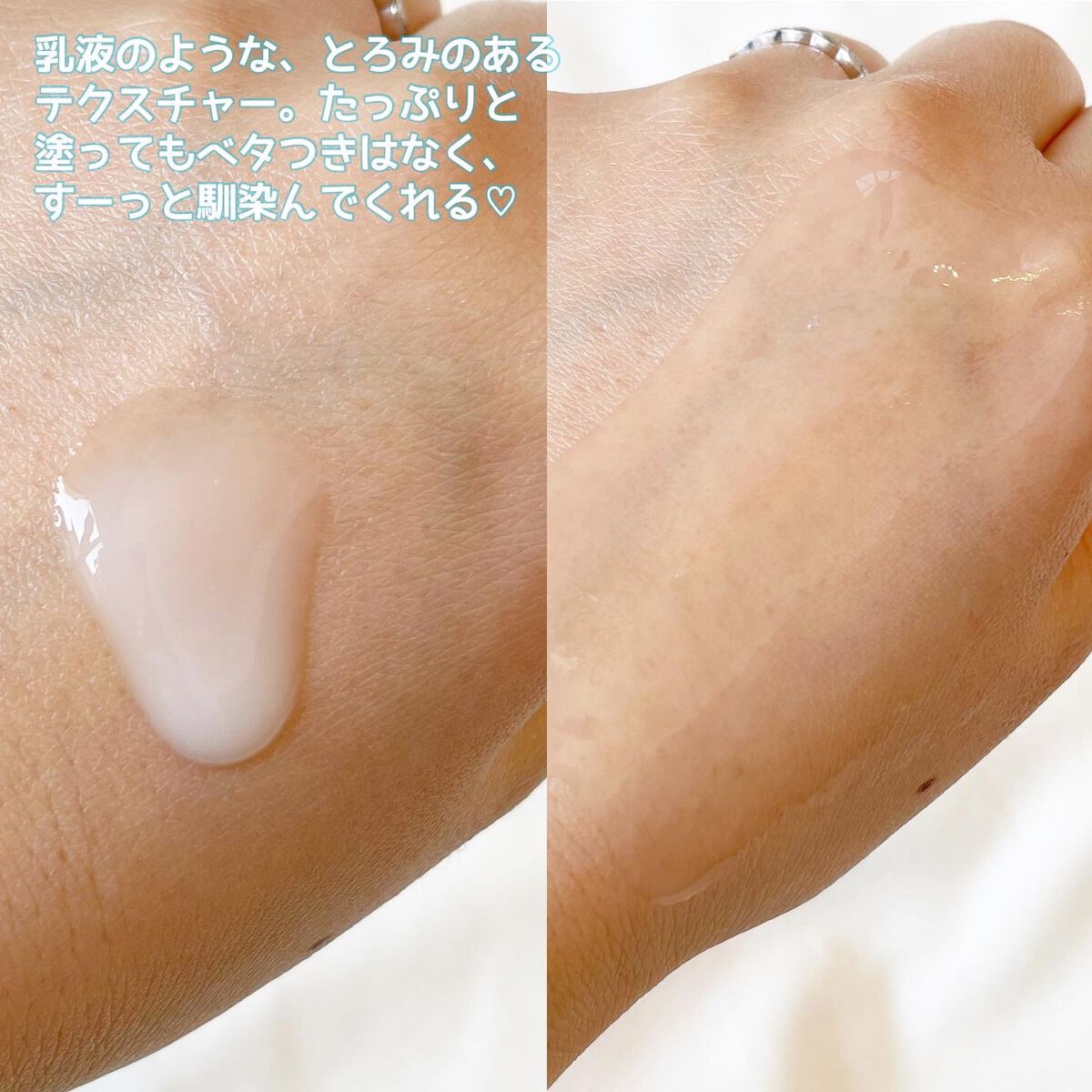 アトバリア365クリーム/AESTURA/フェイスクリームを使ったクチコミ（3枚目）