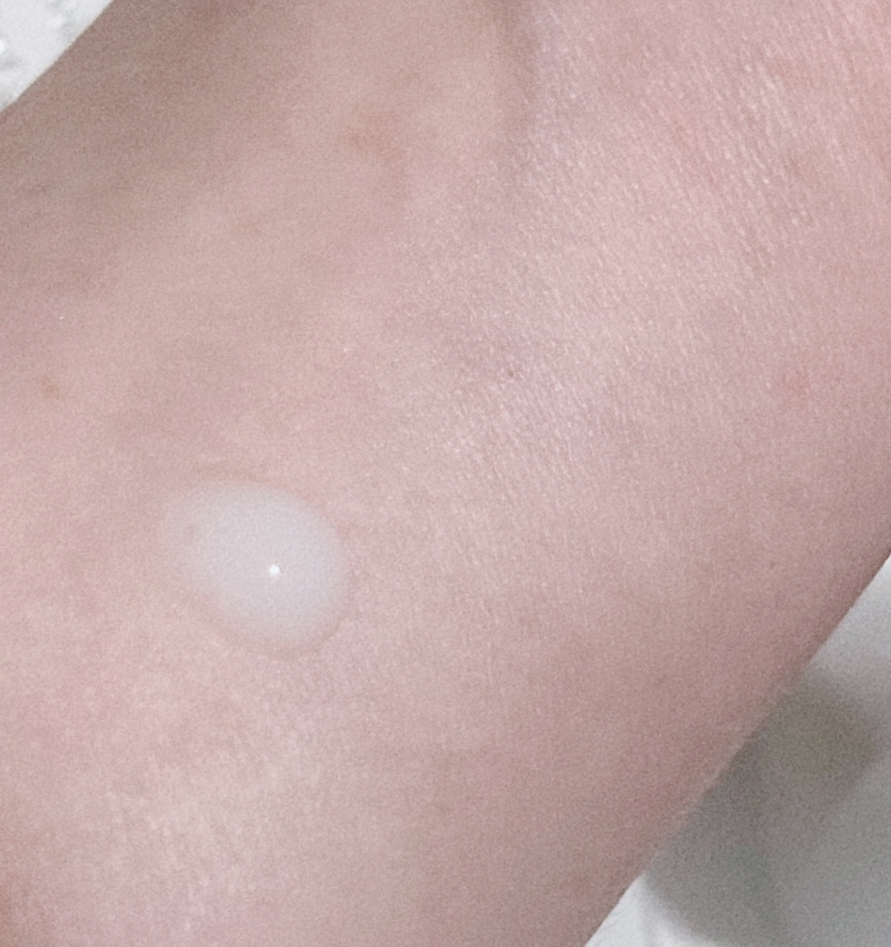 コラゲリードSP/リサージ/美容液を使ったクチコミ（2枚目）