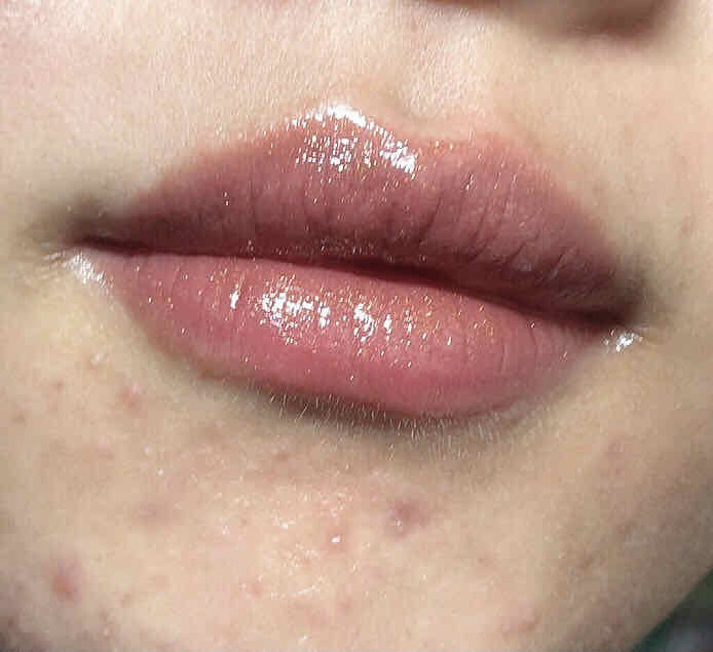 スティックプランパー エクストラセラム/Borica/リッププランパーを使ったクチコミ（2枚目）